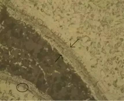 鍛造裂紋 鍛造裂紋